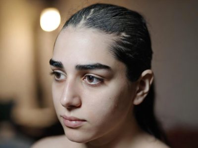 cheghadr-shooreh-khoshk-charb-tafavat-darand