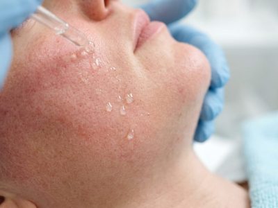 Human_facial_skin_healing_serum